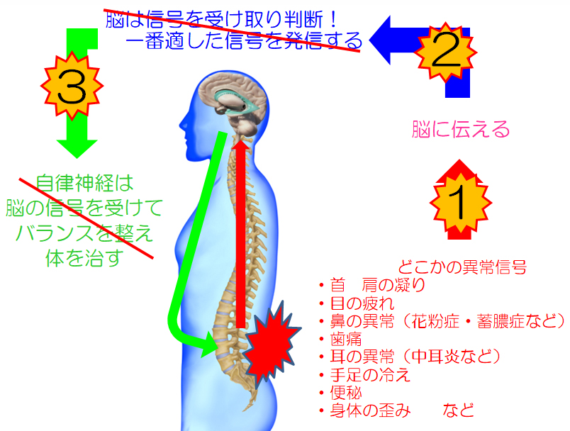 頭痛のシステム